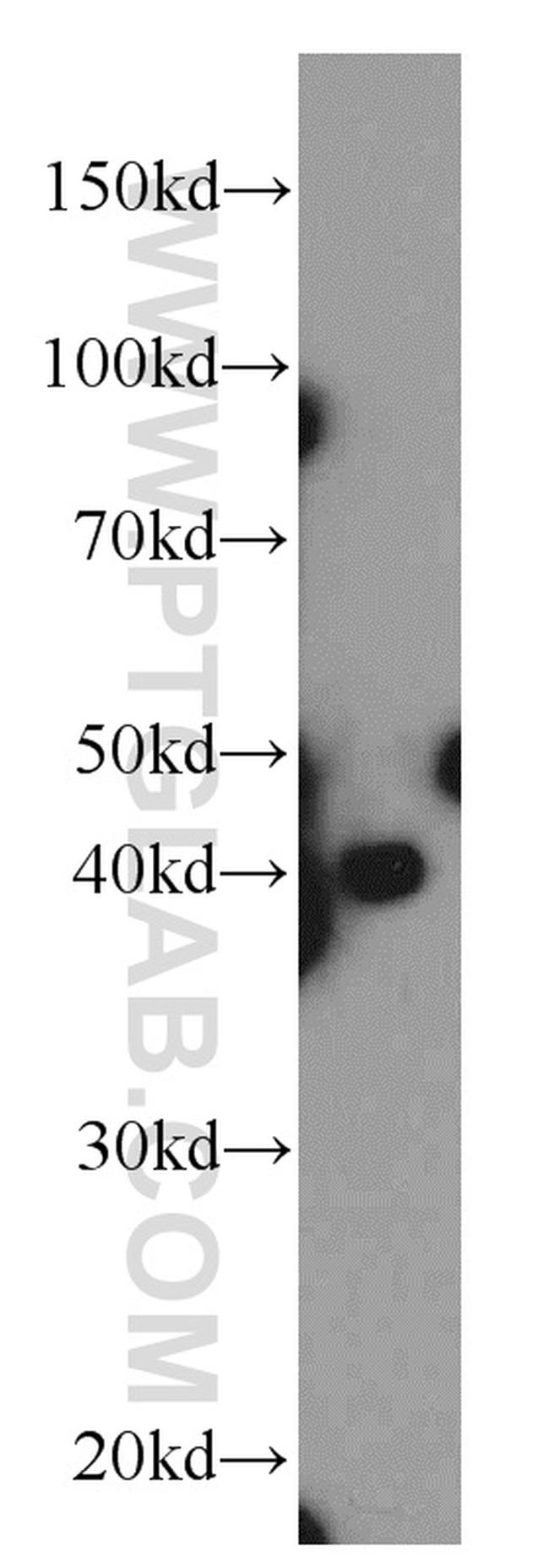 SLC16A12 Antibody in Western Blot (WB)