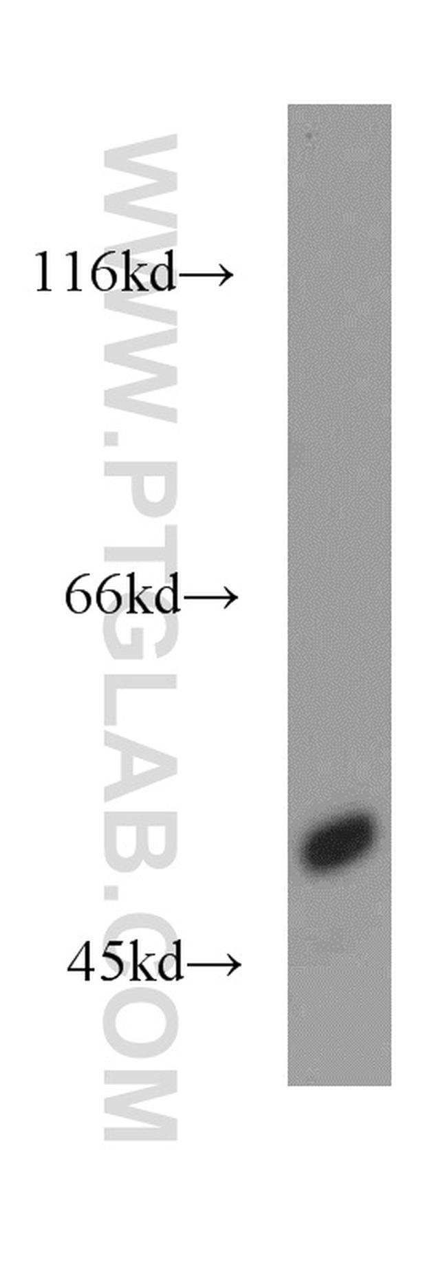 SLC16A12 Antibody in Western Blot (WB)