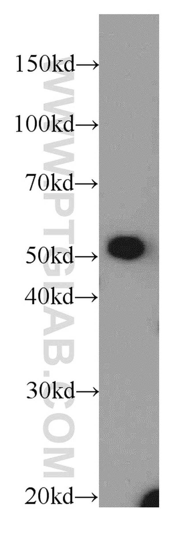 SLC16A12 Antibody in Western Blot (WB)