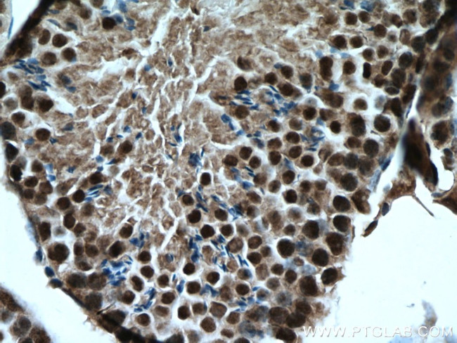 PARP2 Antibody in Immunohistochemistry (Paraffin) (IHC (P))