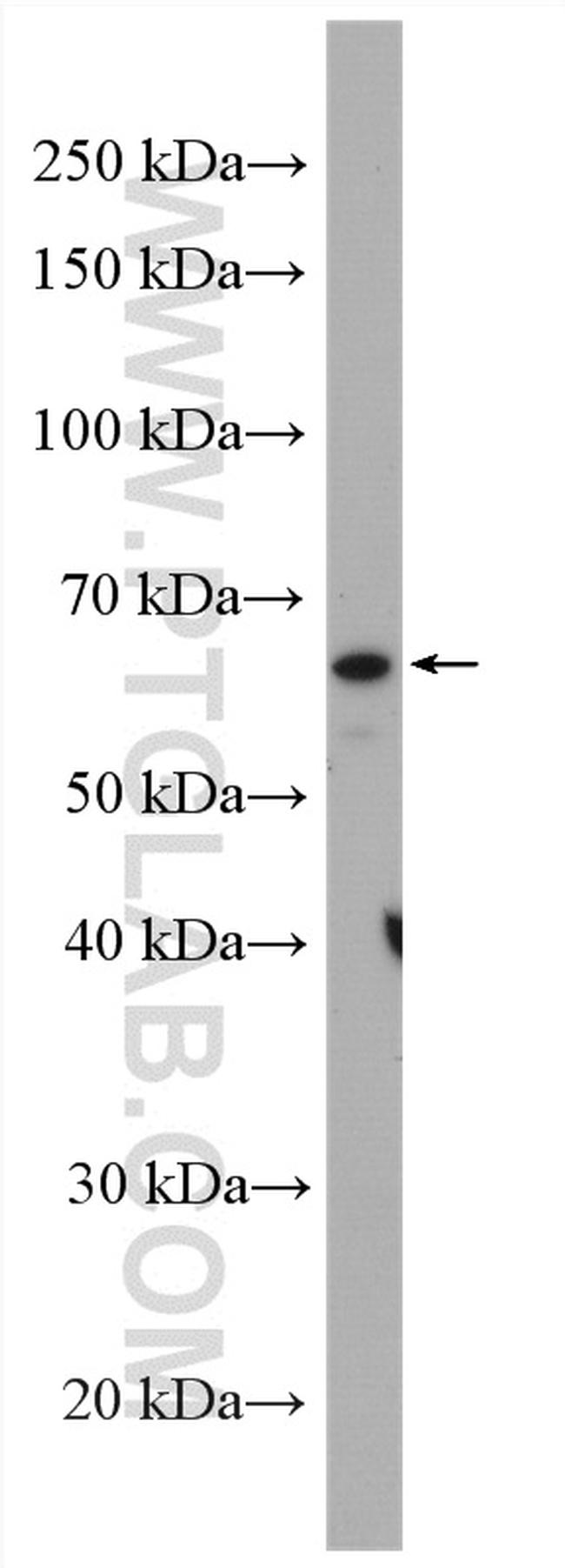 PARP2 Antibody in Western Blot (WB)