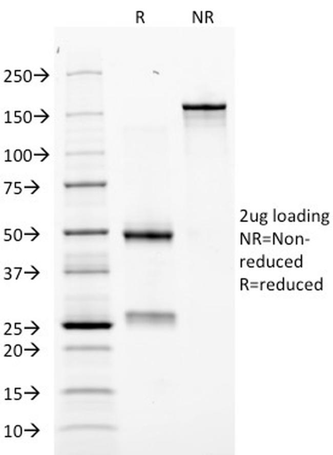 Erythropoietin (EPO) Antibody in SDS-PAGE (SDS-PAGE)