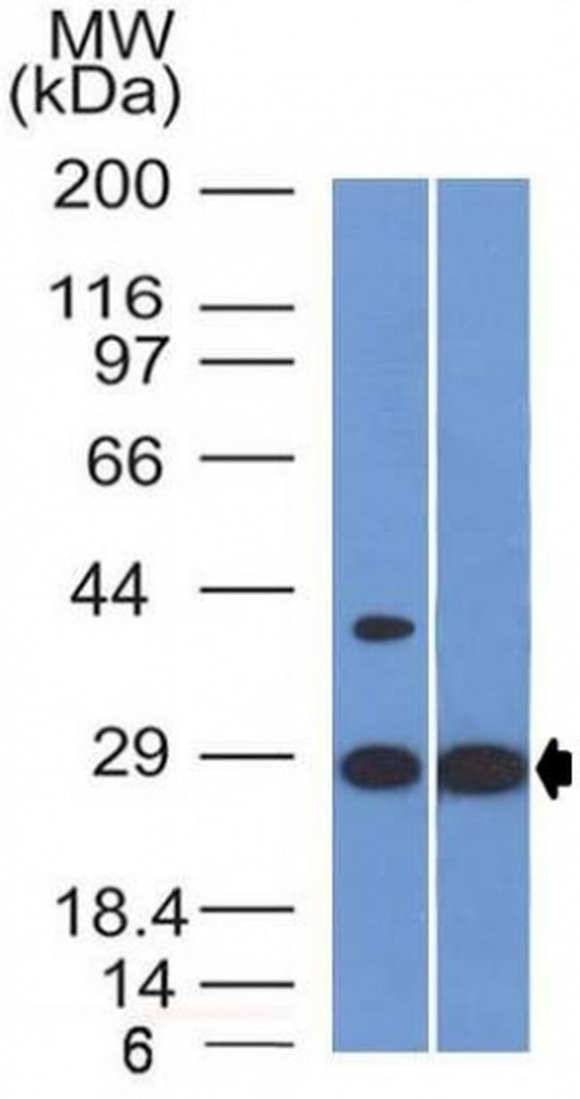 Erythropoietin (EPO) Antibody in Western Blot (WB)