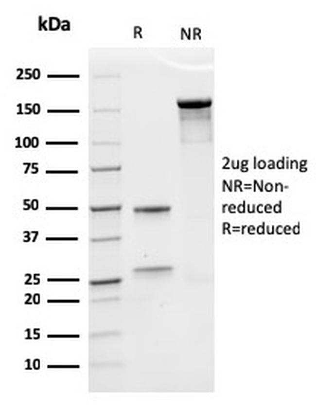 Erythropoietin (EPO) Antibody in SDS-PAGE (SDS-PAGE)