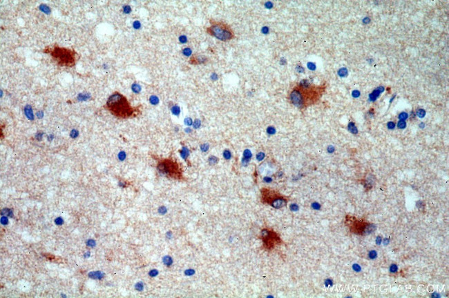 STXBP1 Antibody in Immunohistochemistry (Paraffin) (IHC (P))