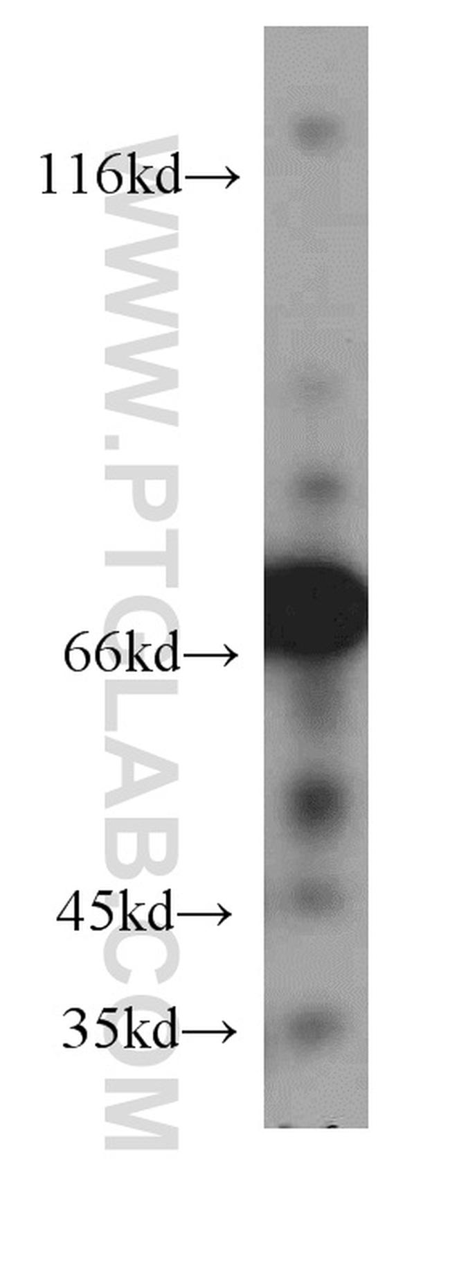 STXBP1 Antibody in Western Blot (WB)