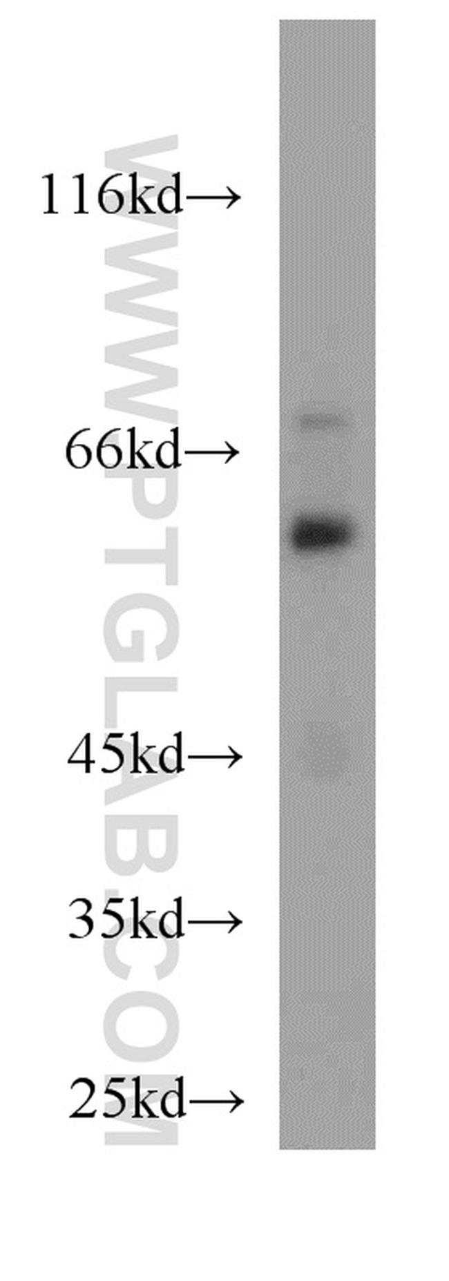 STXBP1 Antibody in Western Blot (WB)