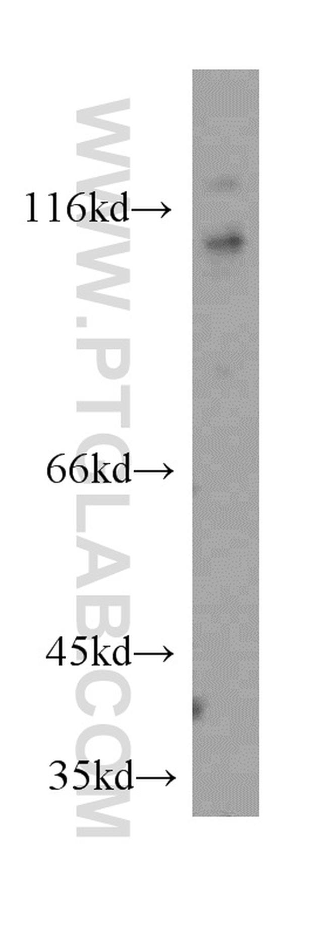 DDX58 Antibody in Western Blot (WB)