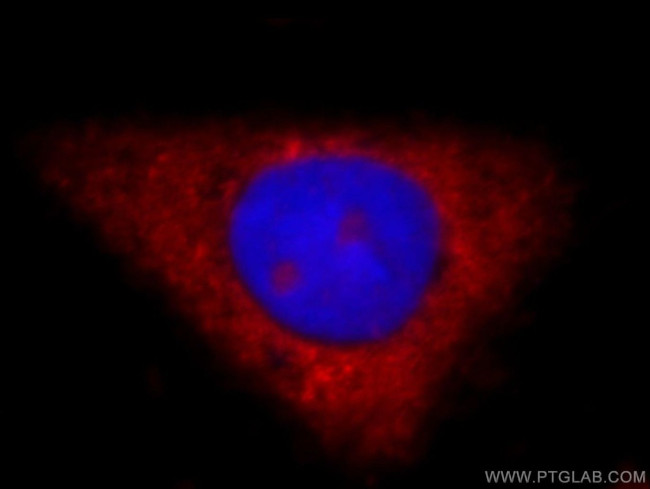 DDX58 Antibody in Immunocytochemistry (ICC/IF)