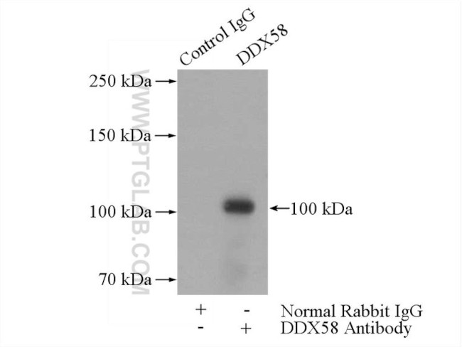 DDX58 Antibody in Immunoprecipitation (IP)