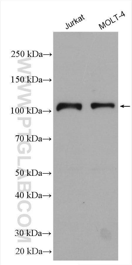 DDX58 Antibody in Western Blot (WB)