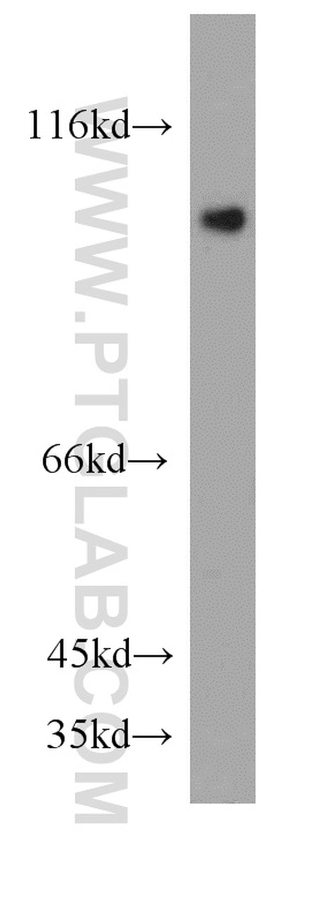 DDX58 Antibody in Western Blot (WB)