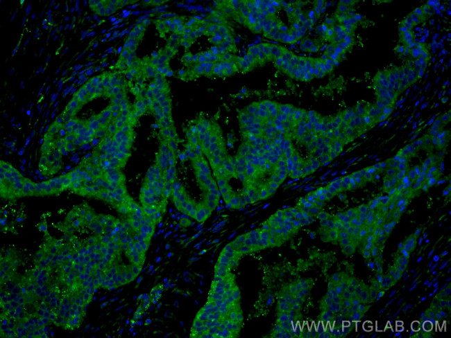 DICER1 Antibody in Immunohistochemistry (PFA fixed) (IHC (PFA))