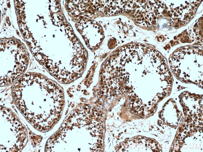 DICER1 Antibody in Immunohistochemistry (Paraffin) (IHC (P))