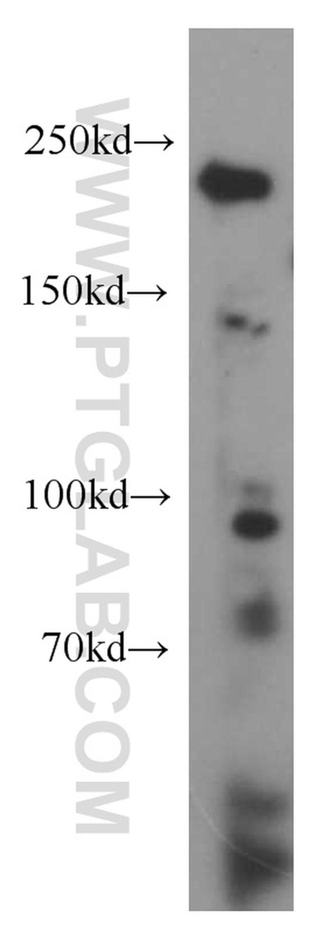 DICER1 Antibody in Western Blot (WB)