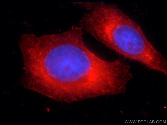 DICER1 Antibody in Immunocytochemistry (ICC/IF)