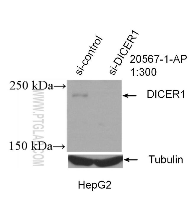 DICER1 Antibody in Western Blot (WB)