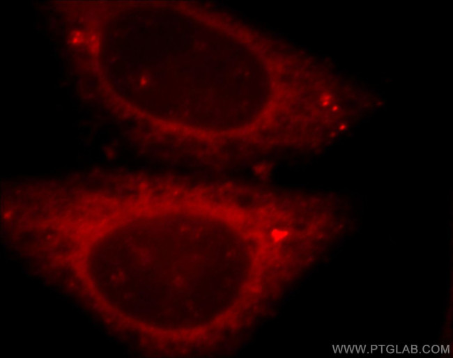 peroxiredoxin 2 Antibody in Immunocytochemistry (ICC/IF)