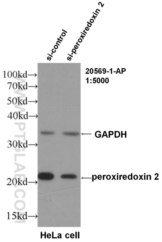 peroxiredoxin 2 Antibody in Western Blot (WB)