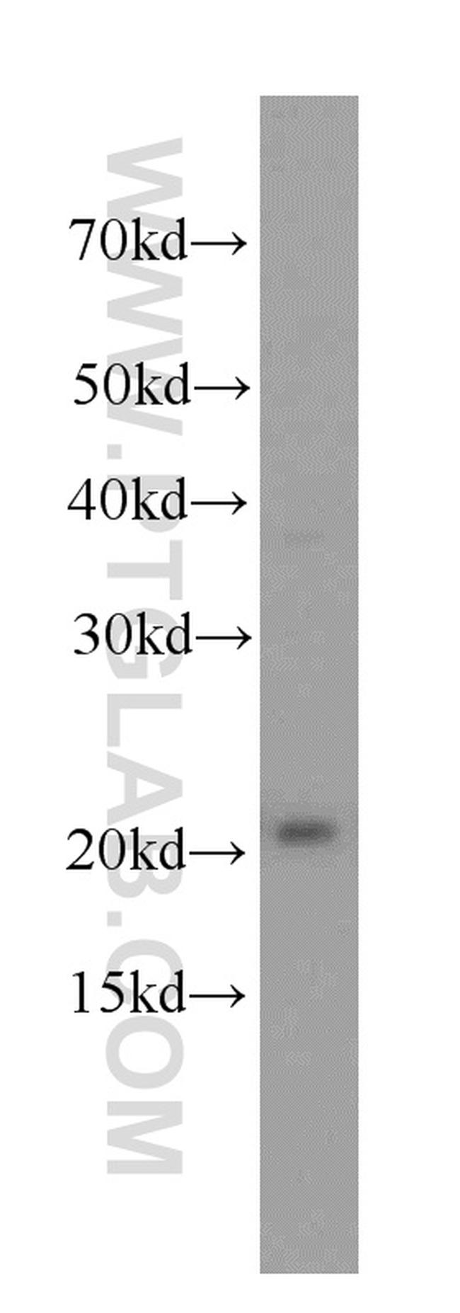 peroxiredoxin 2 Antibody in Western Blot (WB)