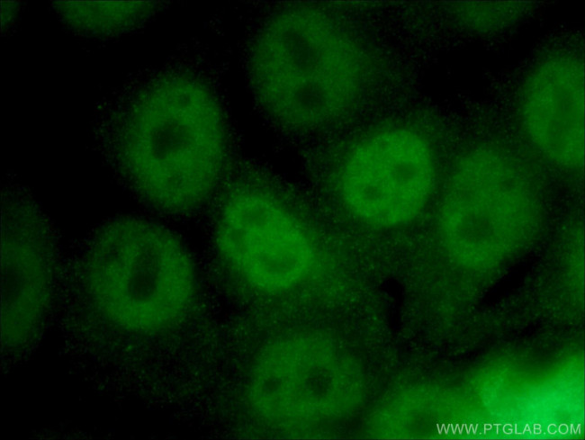 PAX7 Antibody in Immunocytochemistry (ICC/IF)