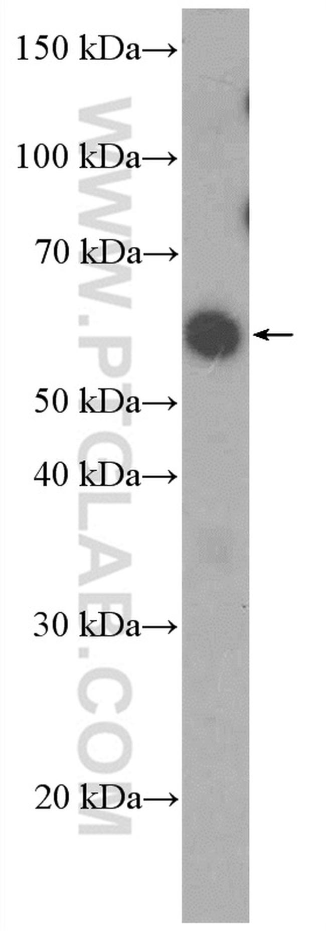 PAX7 Antibody in Western Blot (WB)