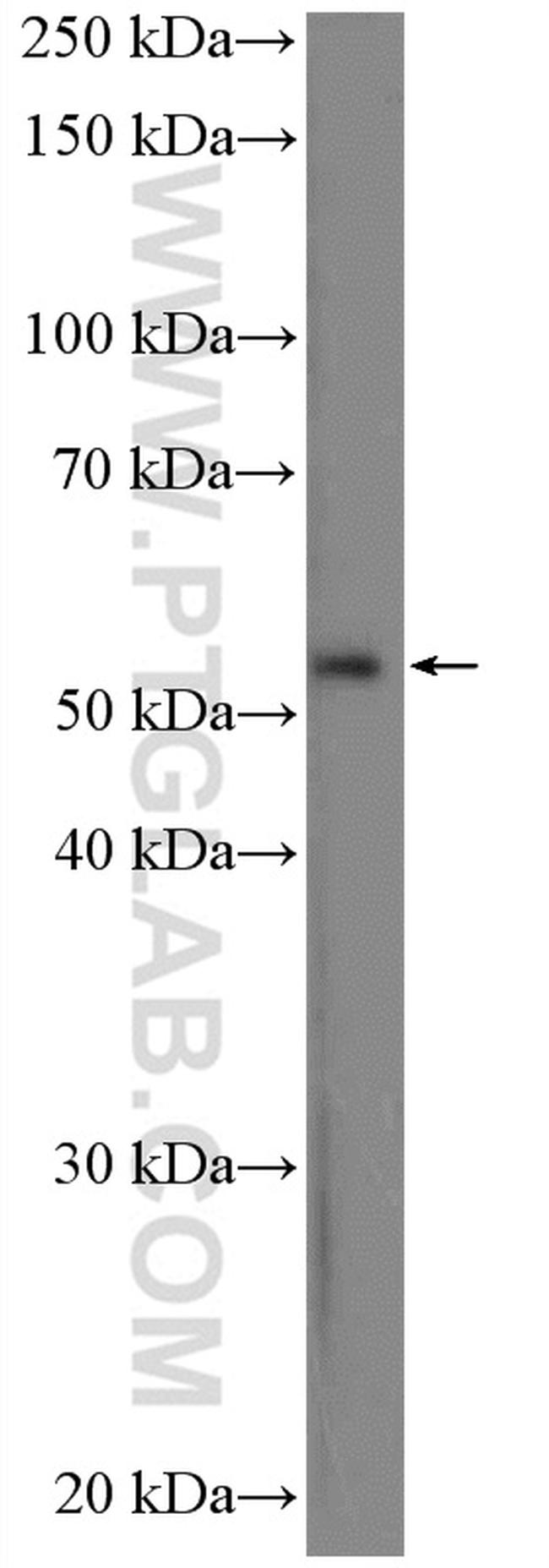 PAX7 Antibody in Western Blot (WB)