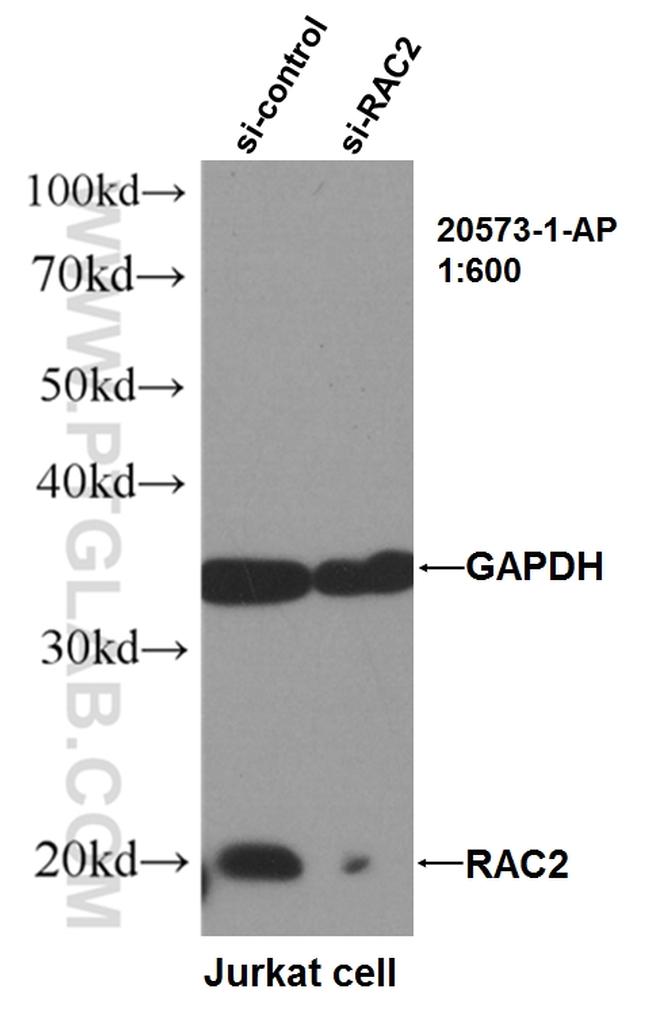 RAC2 Antibody in Western Blot (WB)