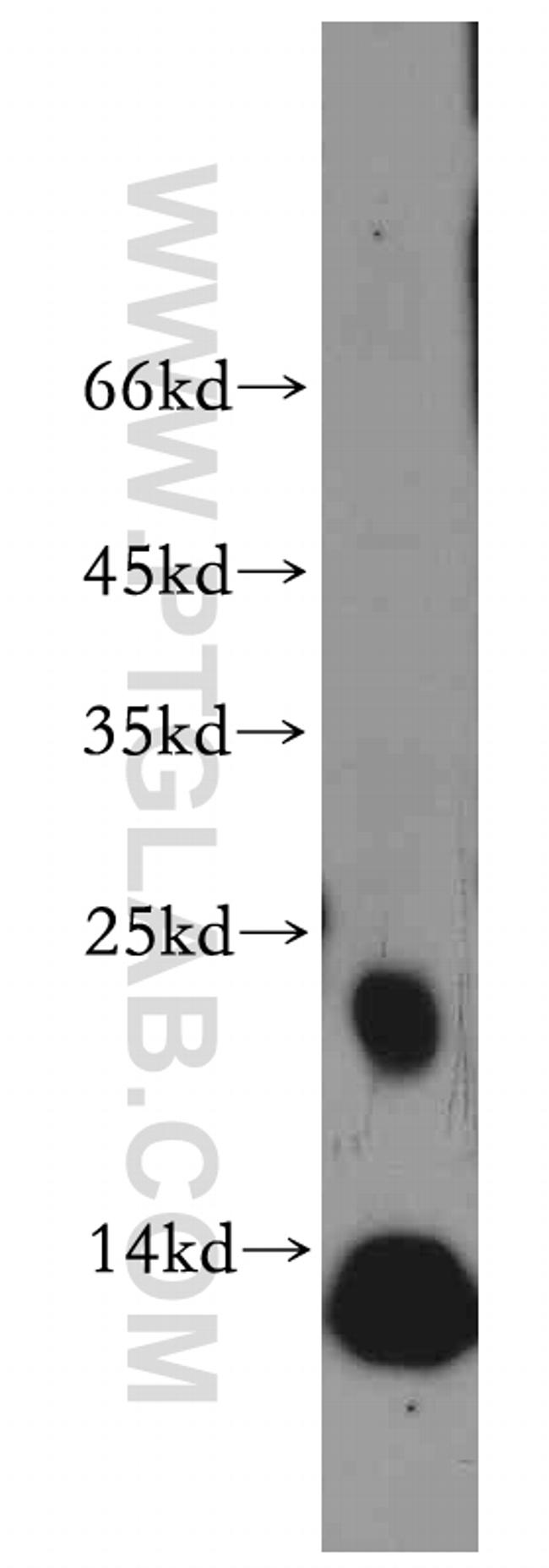 RAC2 Antibody in Western Blot (WB)