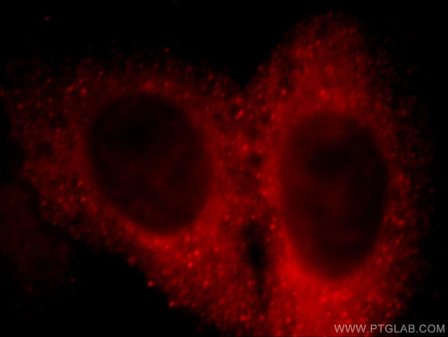 DOC2B Antibody in Immunocytochemistry (ICC/IF)