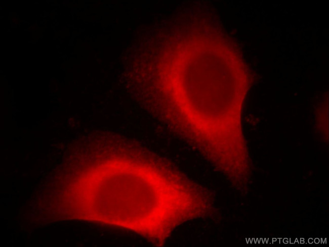 DOC2B Antibody in Immunocytochemistry (ICC/IF)