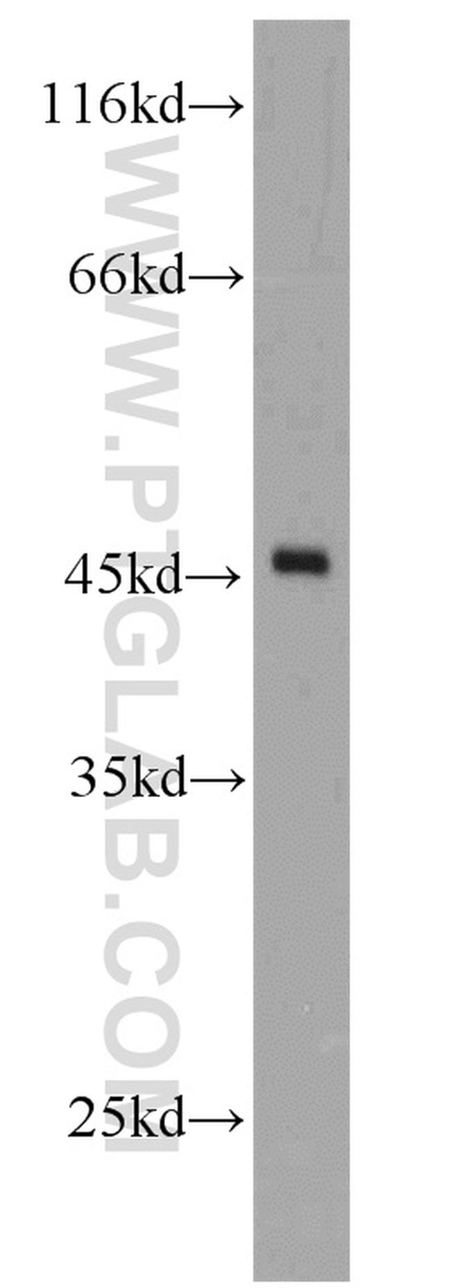 DOC2B Antibody in Western Blot (WB)