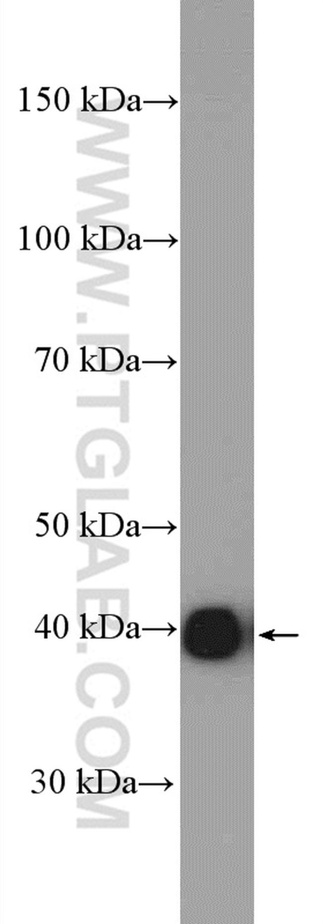 DOC2B Antibody in Western Blot (WB)
