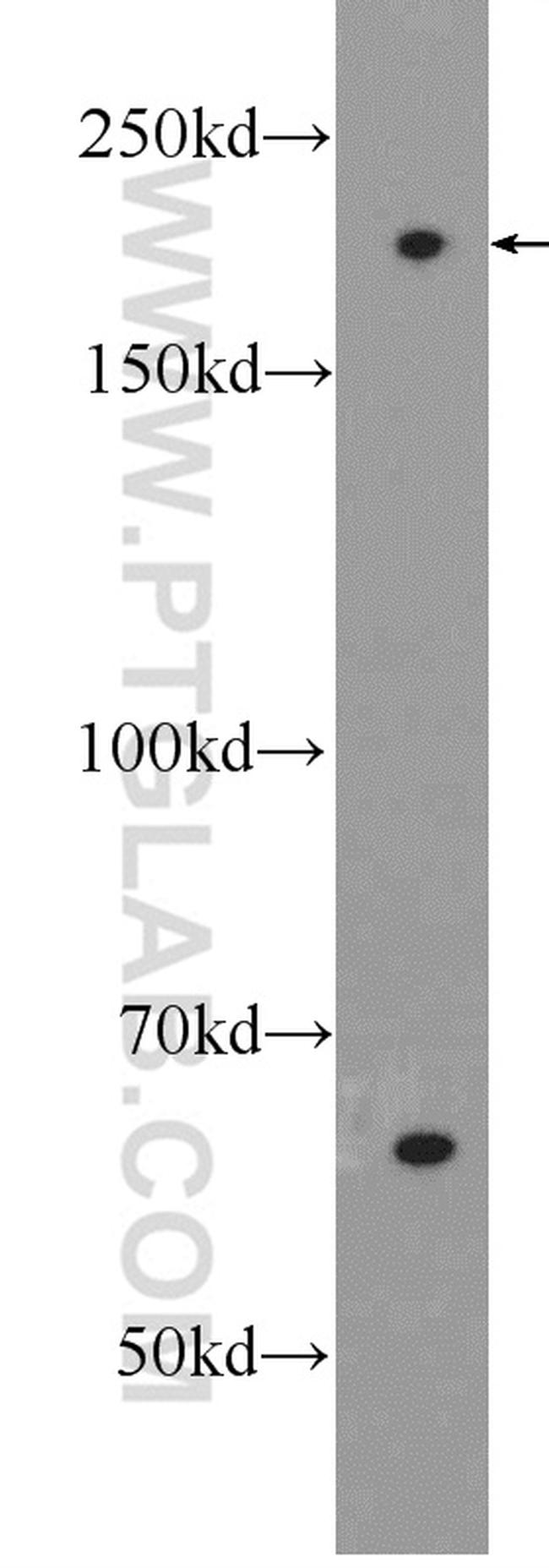 APOB Antibody in Western Blot (WB)