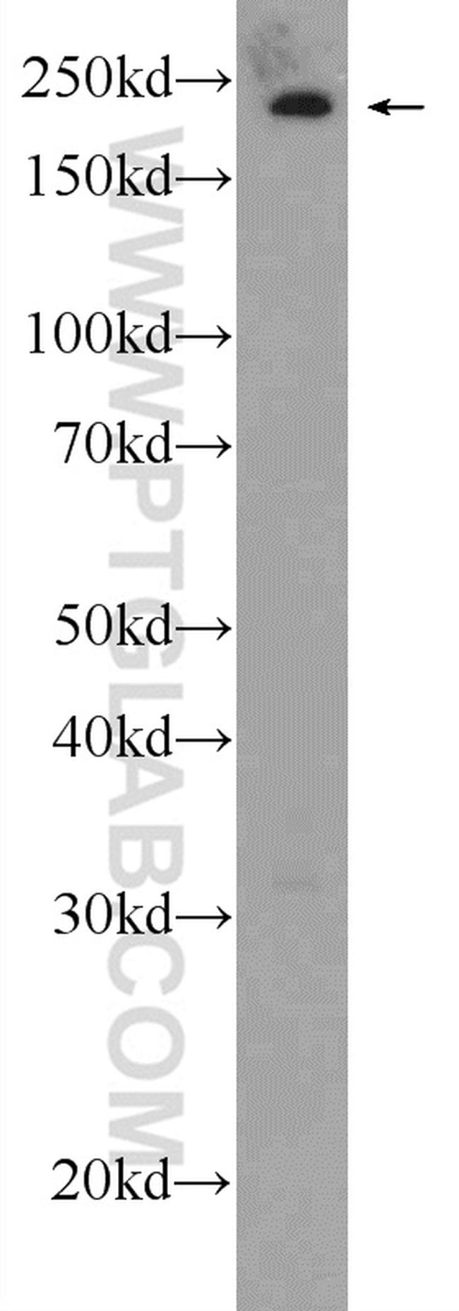 APOB Antibody in Western Blot (WB)