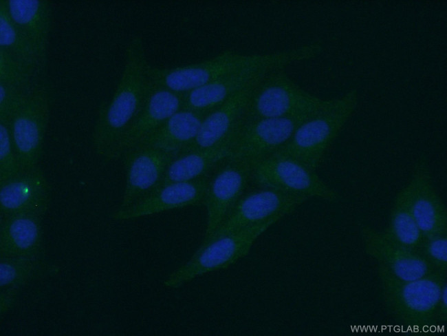 APOB Antibody in Immunocytochemistry (ICC/IF)