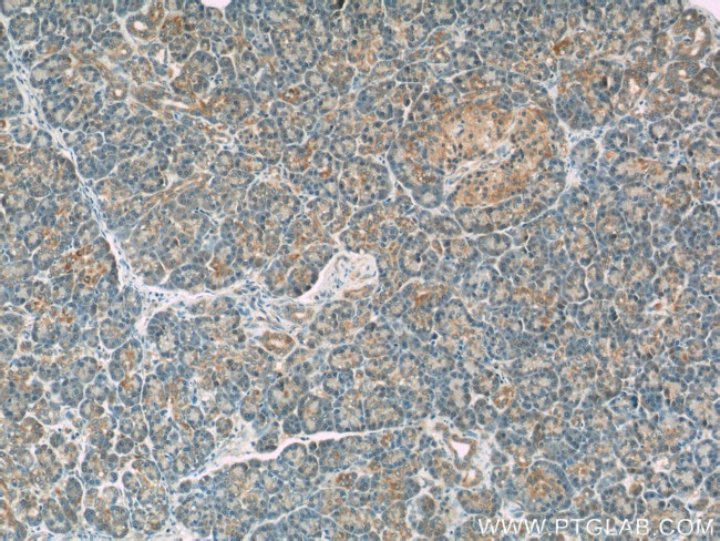 PERK/EIF2AK3 Antibody in Immunohistochemistry (Paraffin) (IHC (P))