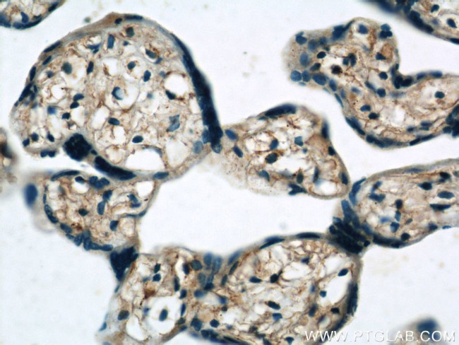 PERK/EIF2AK3 Antibody in Immunohistochemistry (Paraffin) (IHC (P))