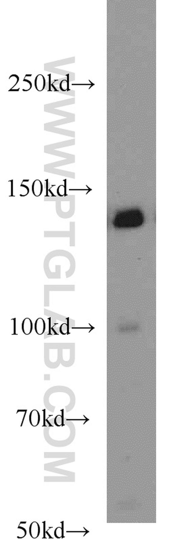 PERK/EIF2AK3 Antibody in Western Blot (WB)