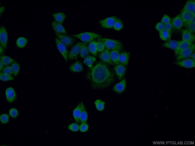 PERK/EIF2AK3 Antibody in Immunocytochemistry (ICC/IF)