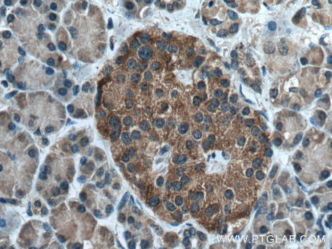 PERK/EIF2AK3 Antibody in Immunohistochemistry (Paraffin) (IHC (P))