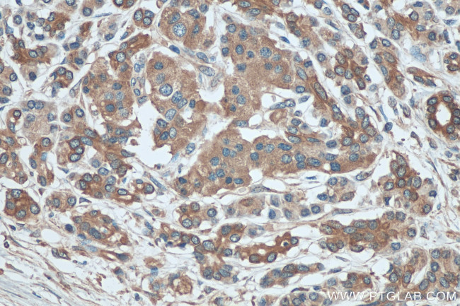 PERK/EIF2AK3 Antibody in Immunohistochemistry (Paraffin) (IHC (P))