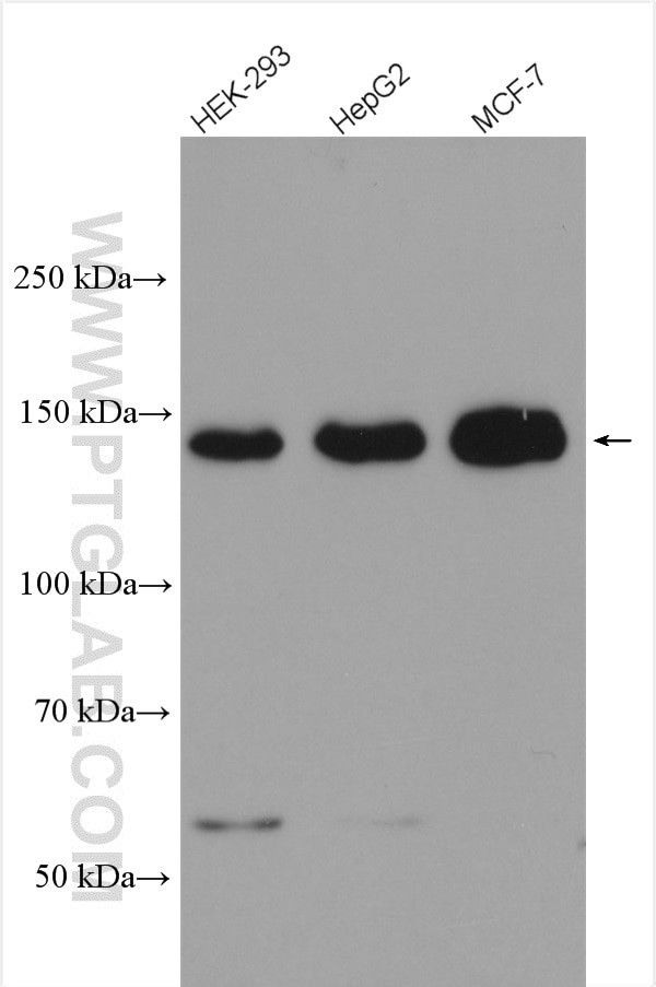 PERK/EIF2AK3 Antibody in Western Blot (WB)