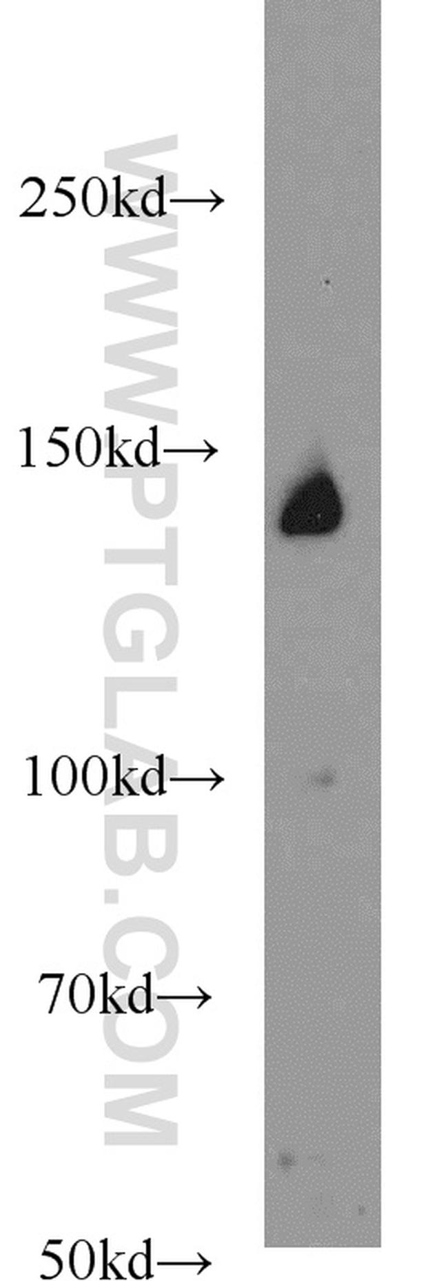 PERK/EIF2AK3 Antibody in Western Blot (WB)