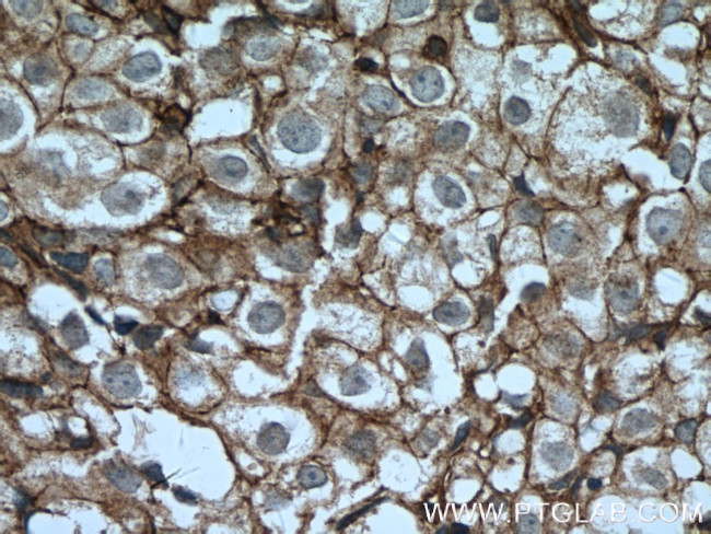 CD9 Antibody in Immunohistochemistry (Paraffin) (IHC (P))