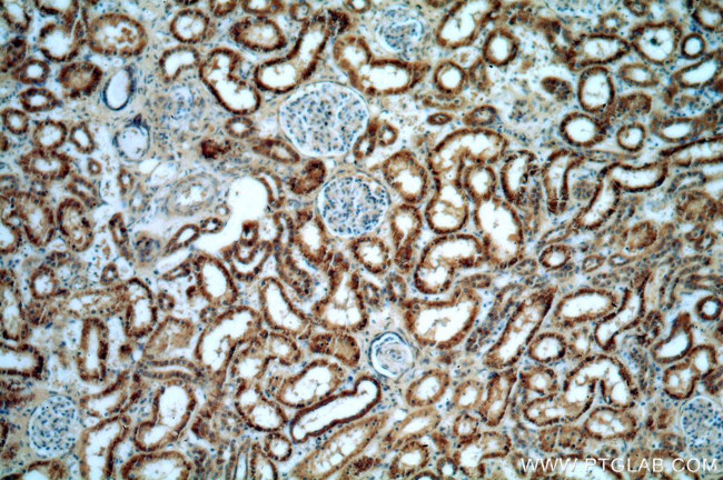 AGPAT9 Antibody in Immunohistochemistry (Paraffin) (IHC (P))