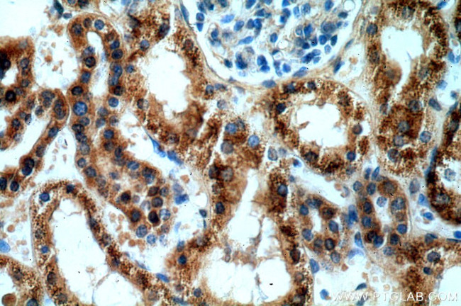 AGPAT9 Antibody in Immunohistochemistry (Paraffin) (IHC (P))