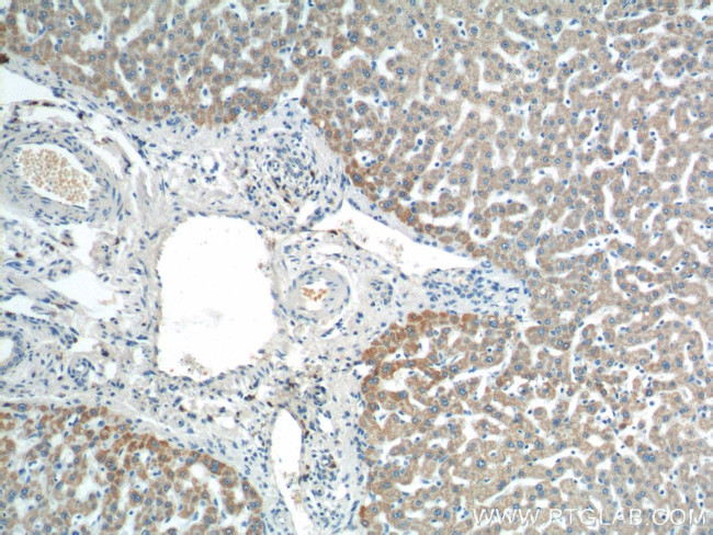 AGPAT9 Antibody in Immunohistochemistry (Paraffin) (IHC (P))