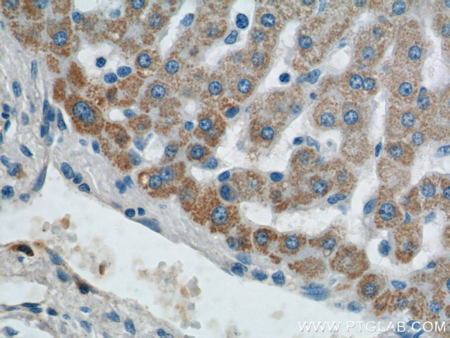 AGPAT9 Antibody in Immunohistochemistry (Paraffin) (IHC (P))