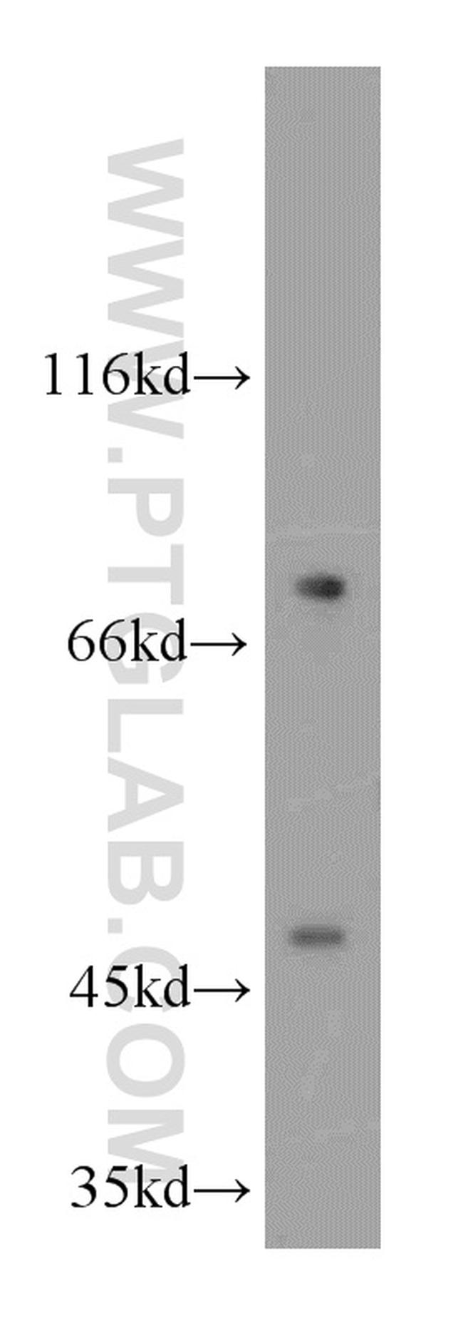 AGPAT9 Antibody in Western Blot (WB)